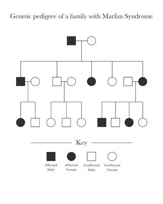 Image of a genetic pedigree of a family with HTAD demonstrating the autosomal dominant pattern of inheritance.